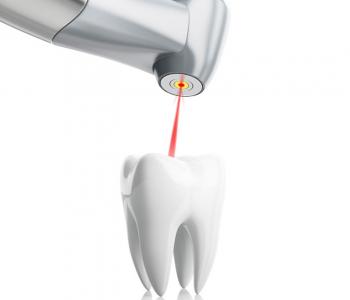 Laser Dentistry